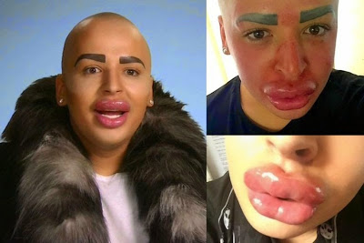 Kim Kardashian superfan who spent £100,000 on surgery gets turned away for more surgery